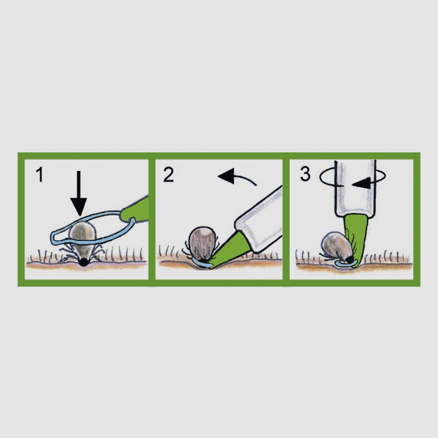 3iX Lasso à tiques / pince à tiques pour humains et animaux, image 2 sur 6