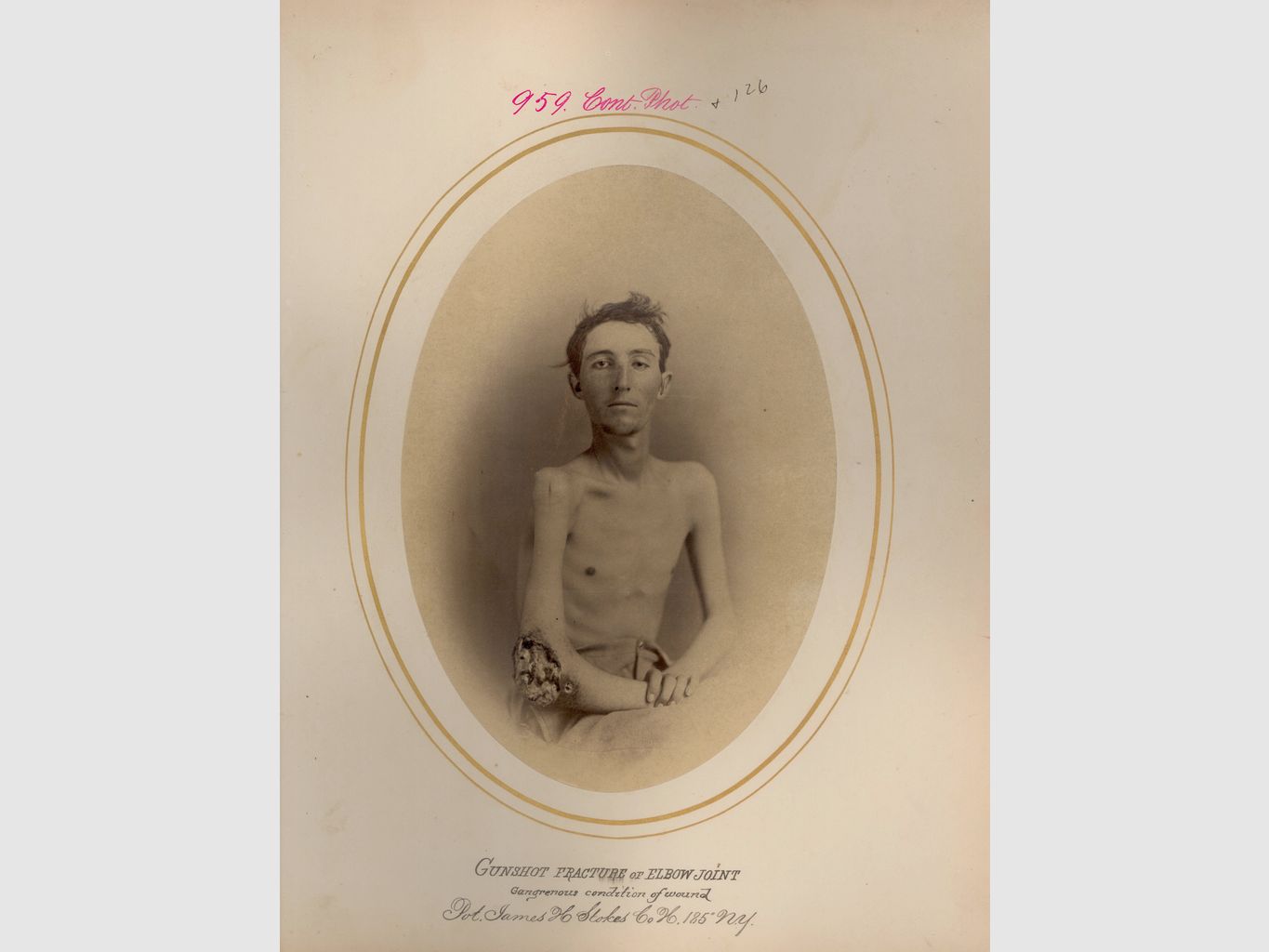 Seltenes Springfield 1861 Gewehr von Cadet – Colt Hartford 1862 – Kal. .58 mit gezogener Lauf für Minié-Geschoss – Mechanik, Markierungen und Lauf mehr als ausgezeichnet – Gewehrriemen – Hervorragend! TBE++, Bild 32 von 32