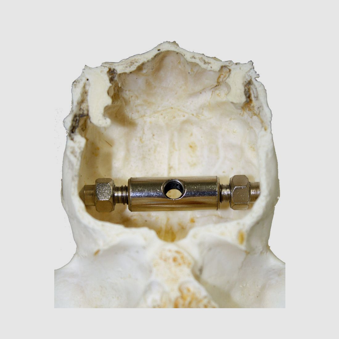Pinza para trofeo de corzo 2 uds., imagen 2 de 4