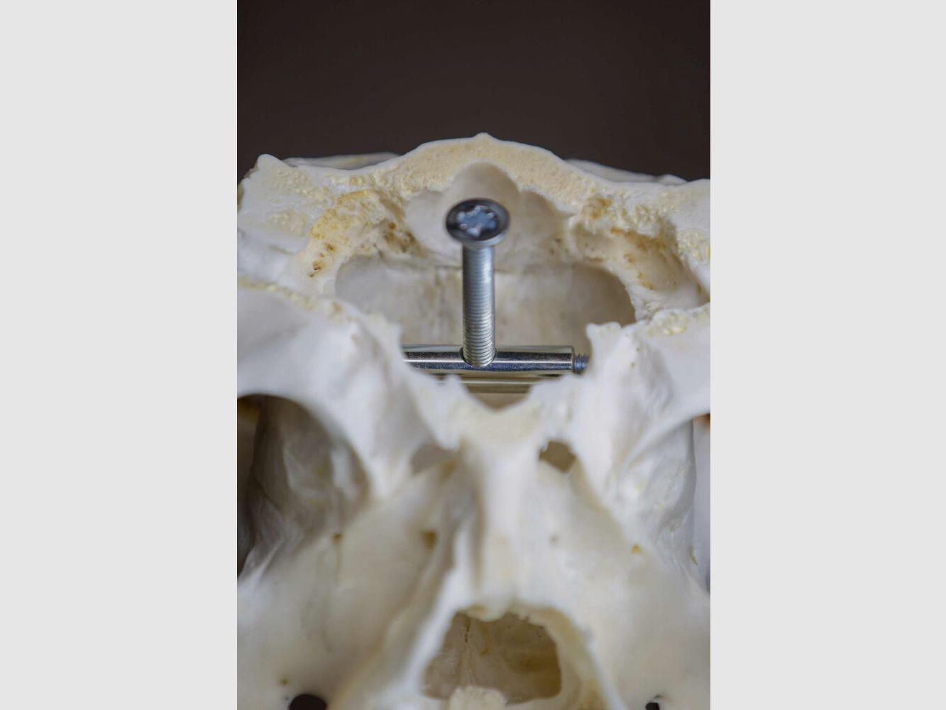 Eurohunt klamra na rogi dla sarny