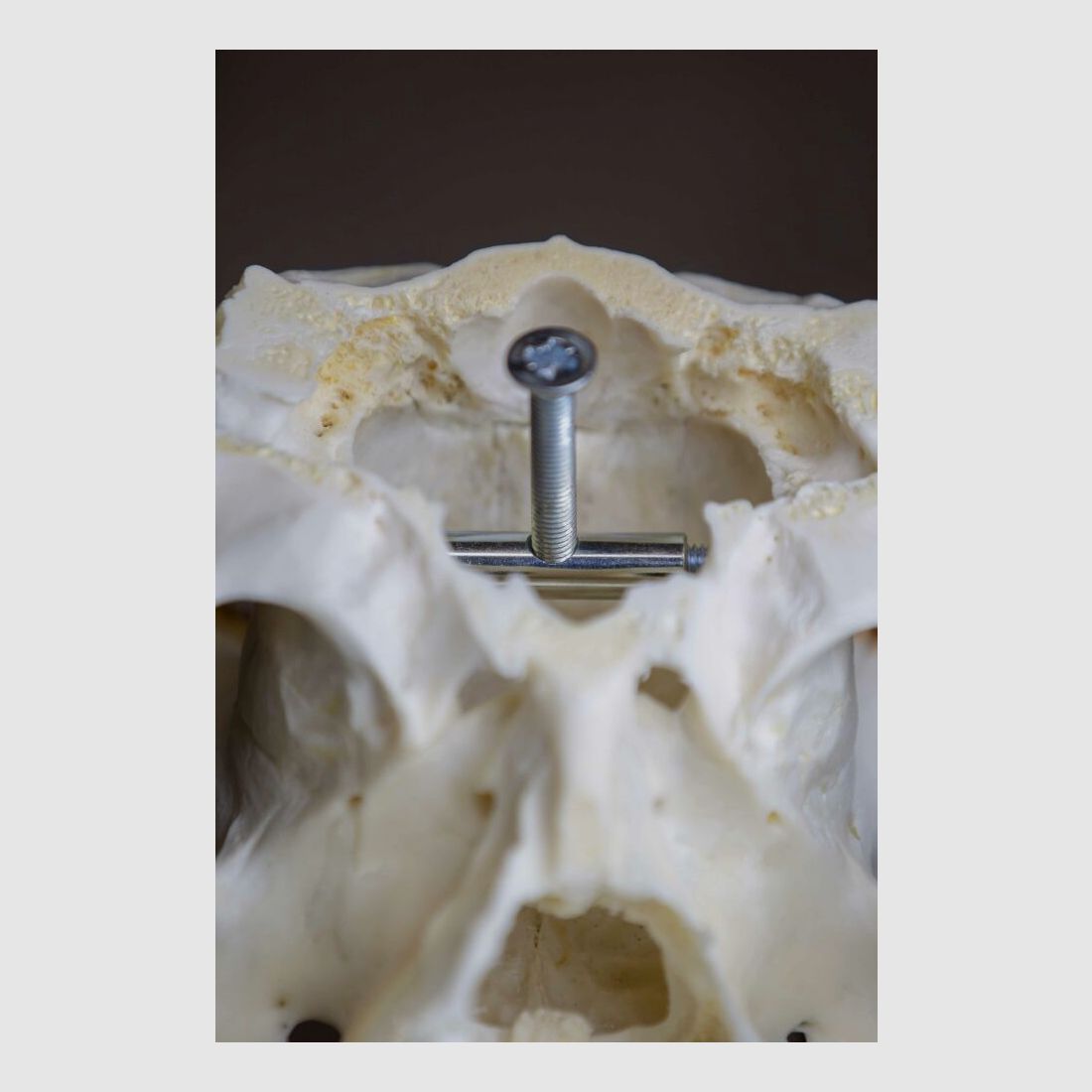 Eurohunt Gehörnklammer für Reh